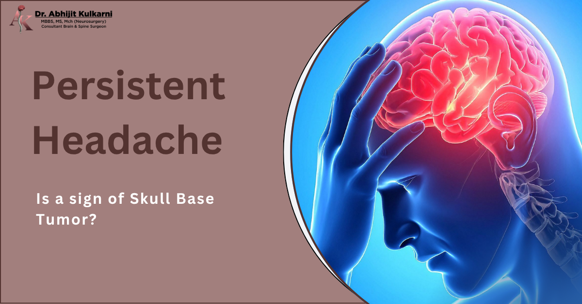 Is Persistent Headache a Sign of Skull Base Tumor?